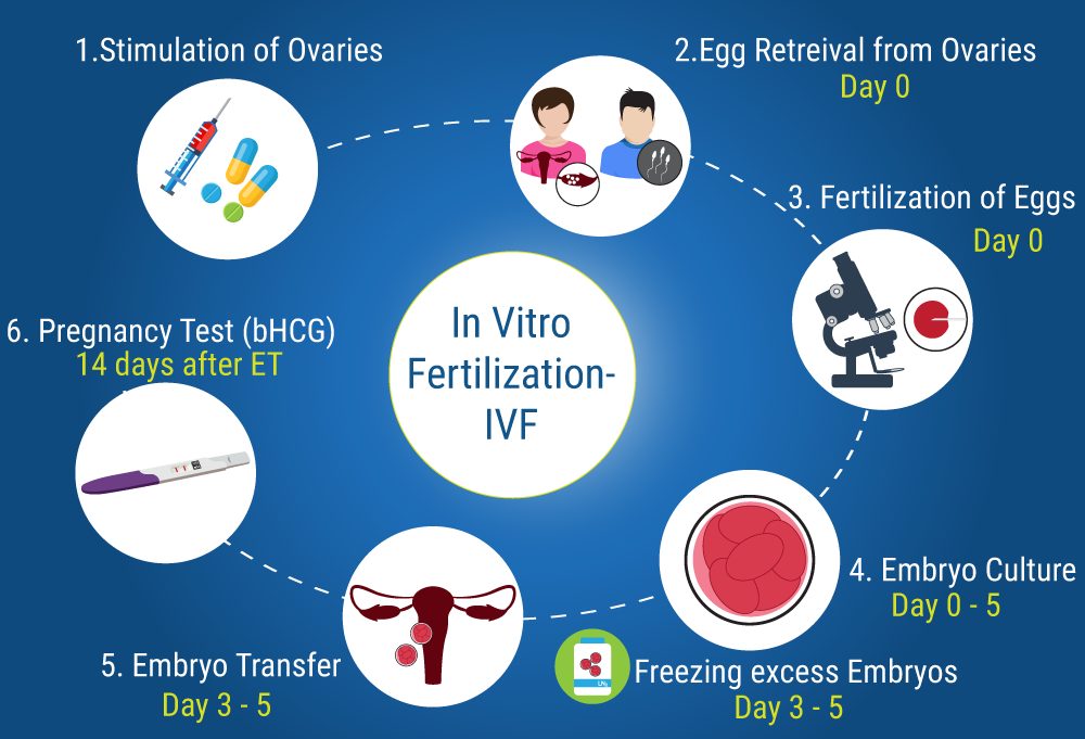 IVF